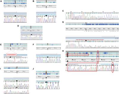 Sanger Validation of High-Throughput Sequencing in Genetic Diagnosis: Still the Best Practice?